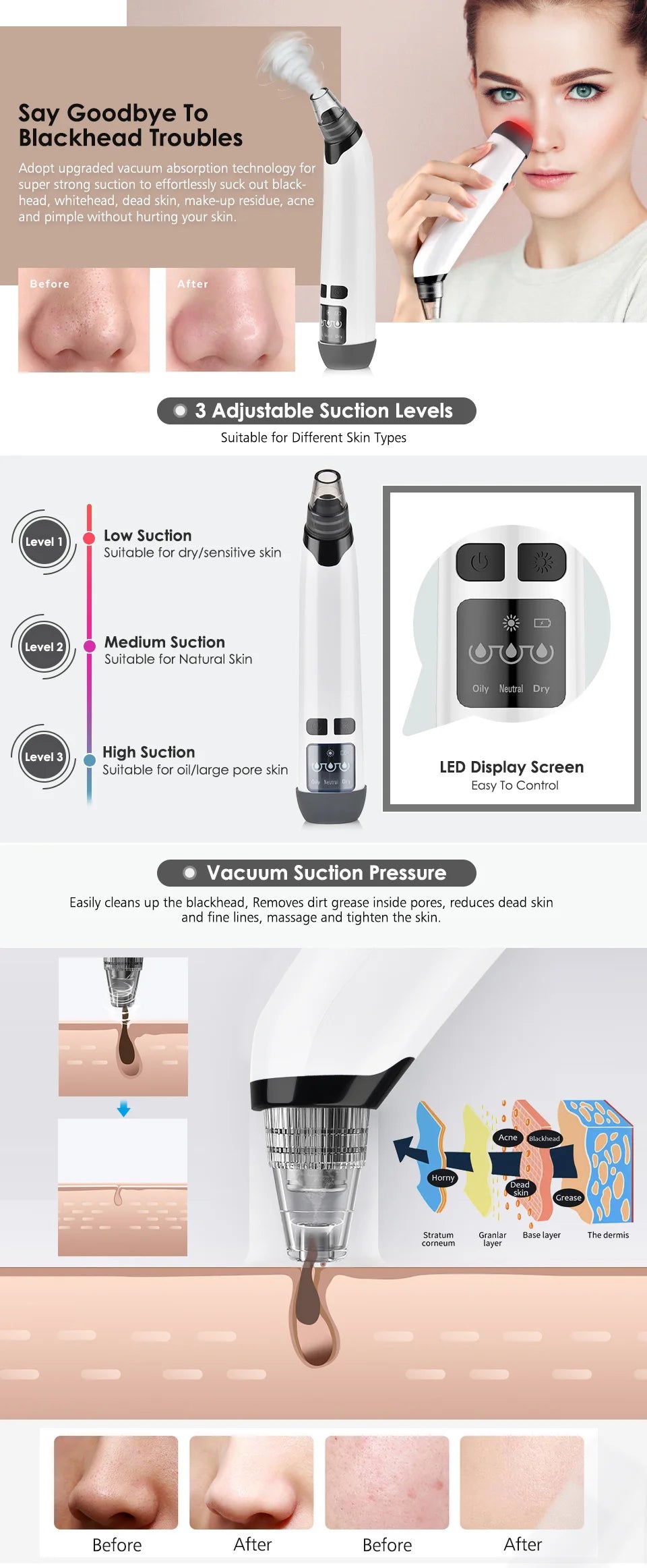 Blackhead Remover Nose T Zone Pore Vacuum Acne Pimple Removal Vacuum Suction Tool Facial Diamond Dermabrasion Machine Face Clean