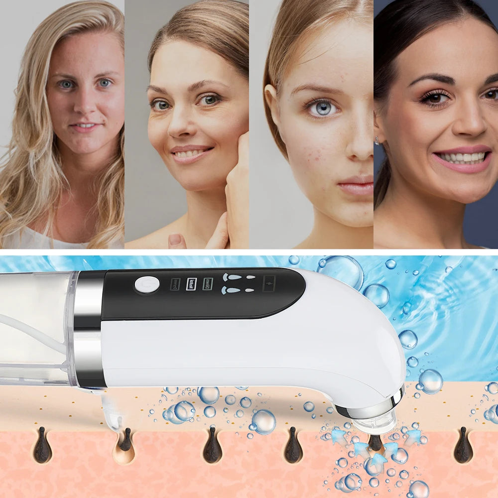 Blackhead Remover Nose T Zone Pore Vacuum Acne Pimple Removal Vacuum Suction Tool Facial Diamond Dermabrasion Machine Face Clean