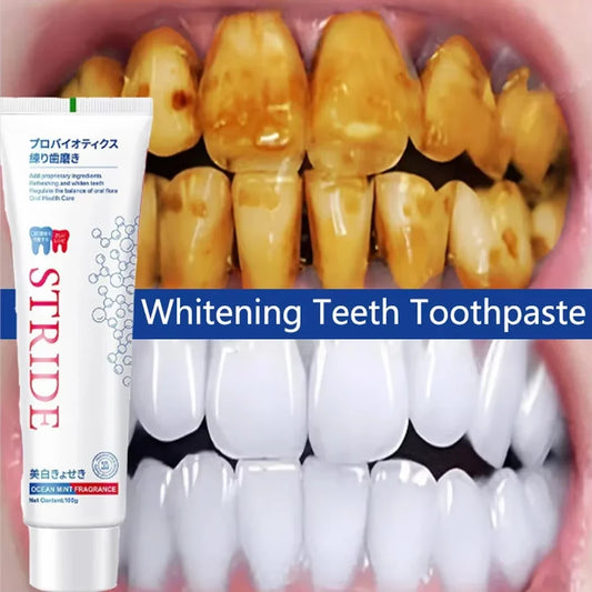 Teeth Whitening Toothpaste Dental Calculus Remover Remove Plaque Stains Prevent Periodontitis Cleaning Oral HygieneFresh Breath