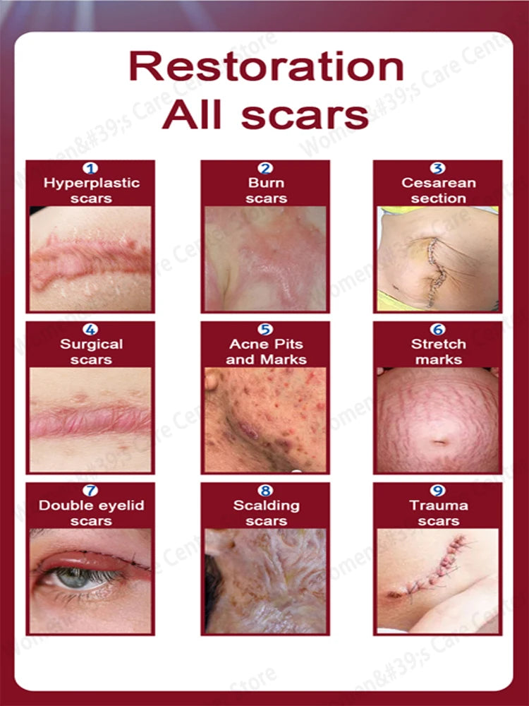 Scar Products