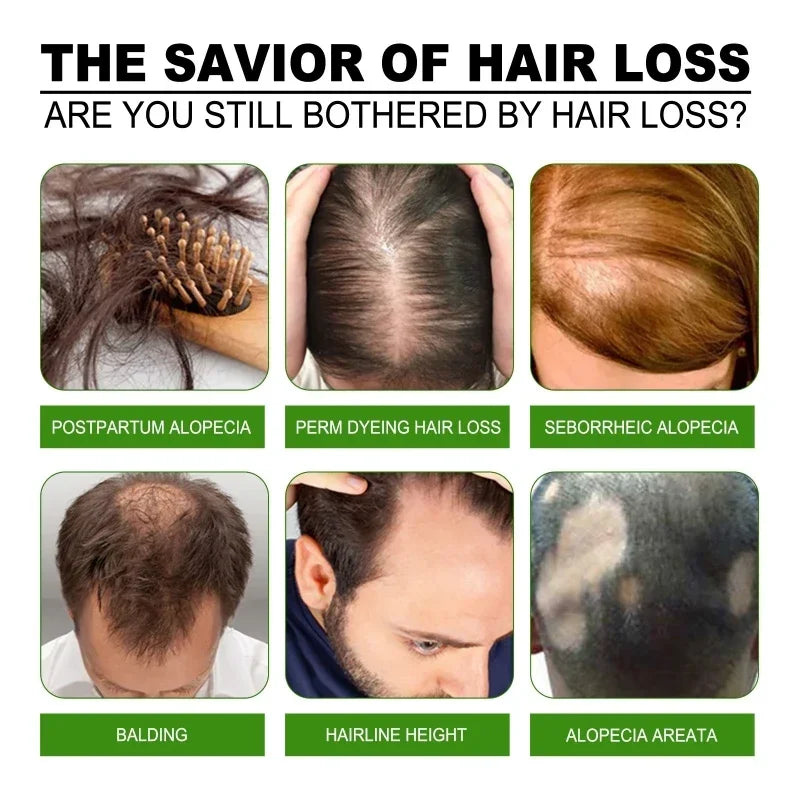 Hot selling product, 99% of buyers buy again, have more and more hair, say goodbye to baldness, thick hair