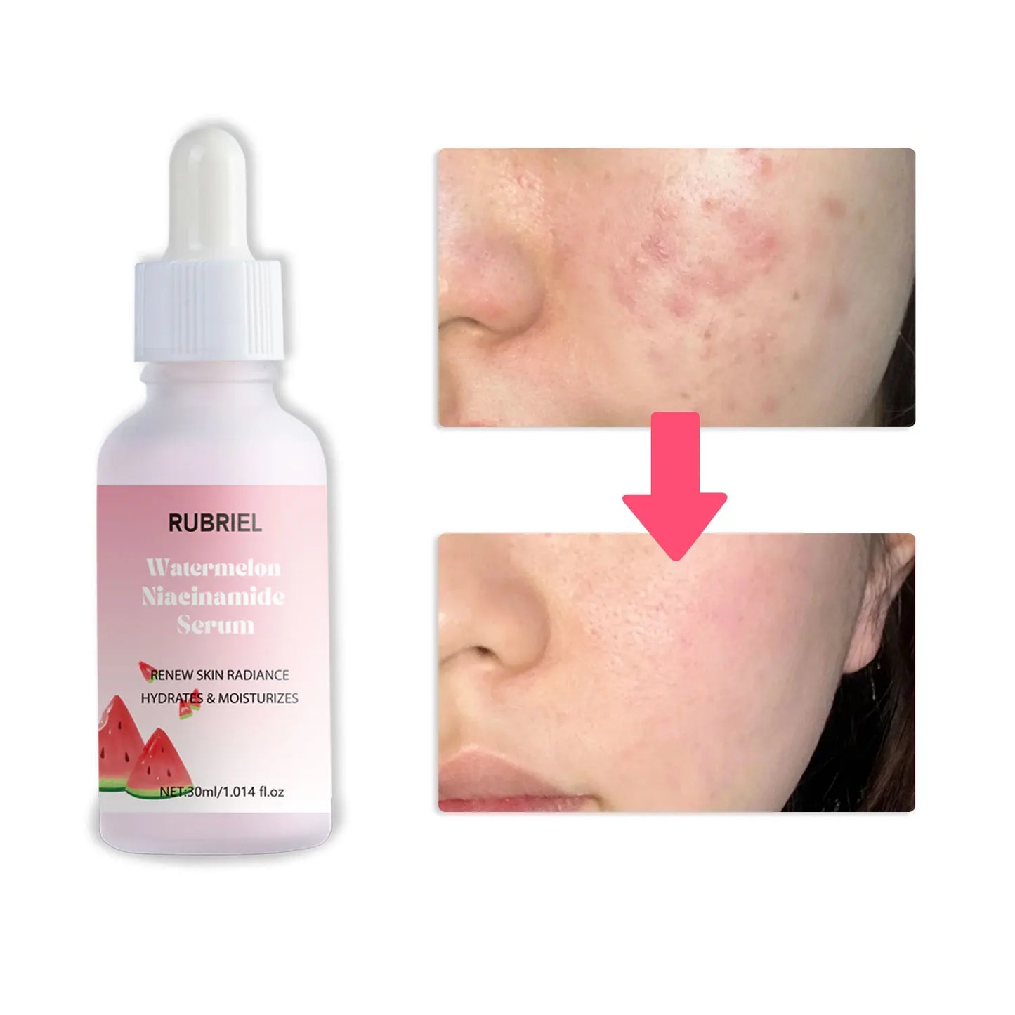 Watermelon Niacinamide Serum Facial Glow Serum Makeup Primer Hydrating Essence Lightweight Moisturizing Facial Serum