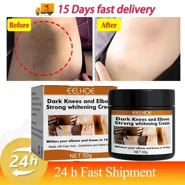 Body Whitening Cream Private Parts Underarm Bleaching Serum Whiten Butt Knee Brighten Inner Thigh Intimate Dark Remove Melanin