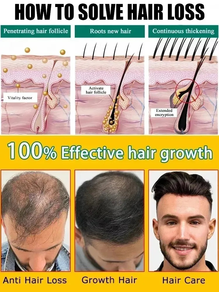 Hot selling product, 99% of buyers buy again, have more and more hair, say goodbye to baldness, thick hair