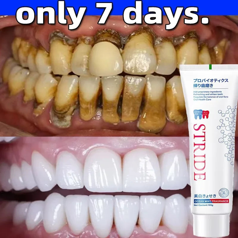 Teeth Whitening Toothpaste Dental Calculus Remover Remove Plaque Stains Prevent Periodontitis Cleaning Oral HygieneFresh Breath