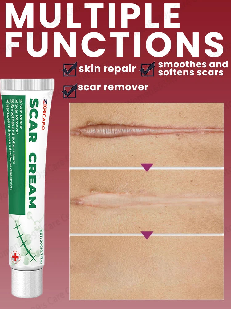 Scar Products