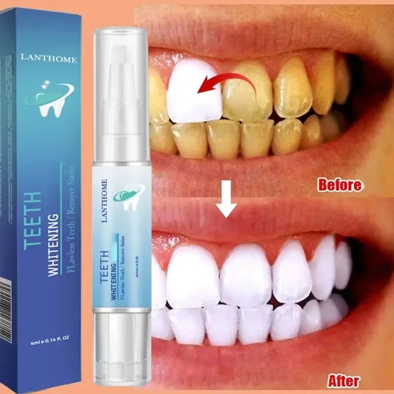 Teeth Whitening Toothpaste Dental Calculus Remover Remove Plaque Stains Prevent Periodontitis Cleaning Oral HygieneFresh Breath