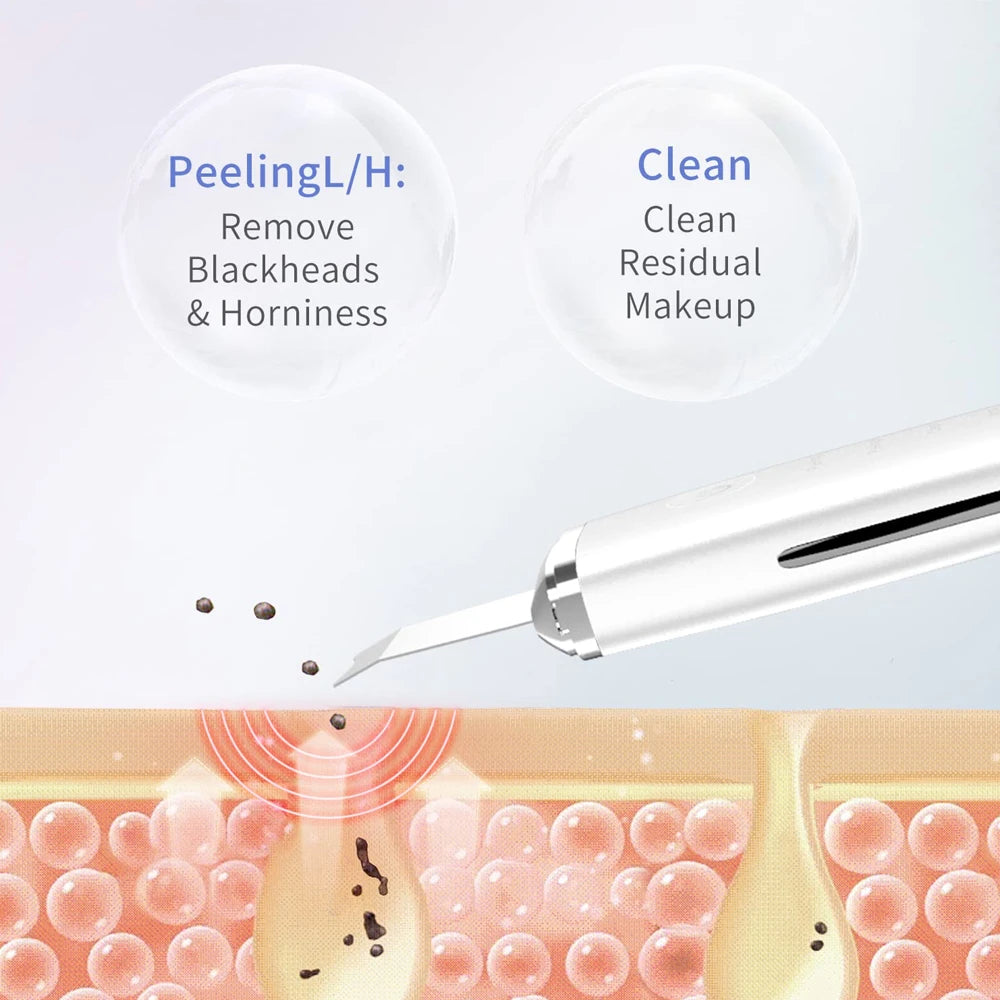 Ultrasonic Skin Scraper Peeling Blackhead Remover Deep Face Cleaning Lifting Acne Pore Cleaner Facial Spatula Shovel Cleanser