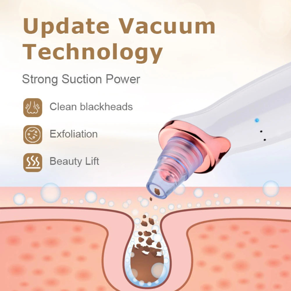 Professional ultra-fine bubble electric blackhead remover, facial vacuum cleaner, acne and pore extraction, facial cleansing, pe