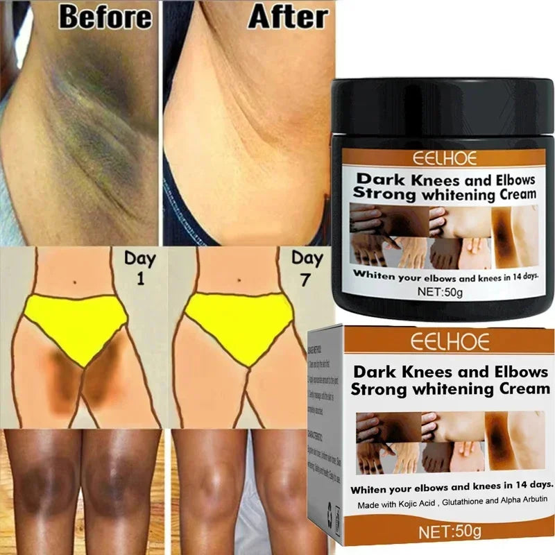 Body Whitening Cream Private Parts Underarm Bleaching Serum Whiten Butt Knee Brighten Inner Thigh Intimate Dark Remove Melanin