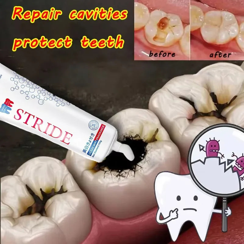 Teeth Whitening Toothpaste Dental Calculus Remover Remove Plaque Stains Prevent Periodontitis Cleaning Oral HygieneFresh Breath