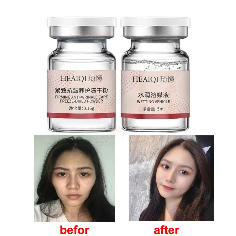 Erythrocyte Lyophilized Powder Stem Cells Plumping Restructuring Depressions Forehead Lines Acne Marks Anti-aging Firming