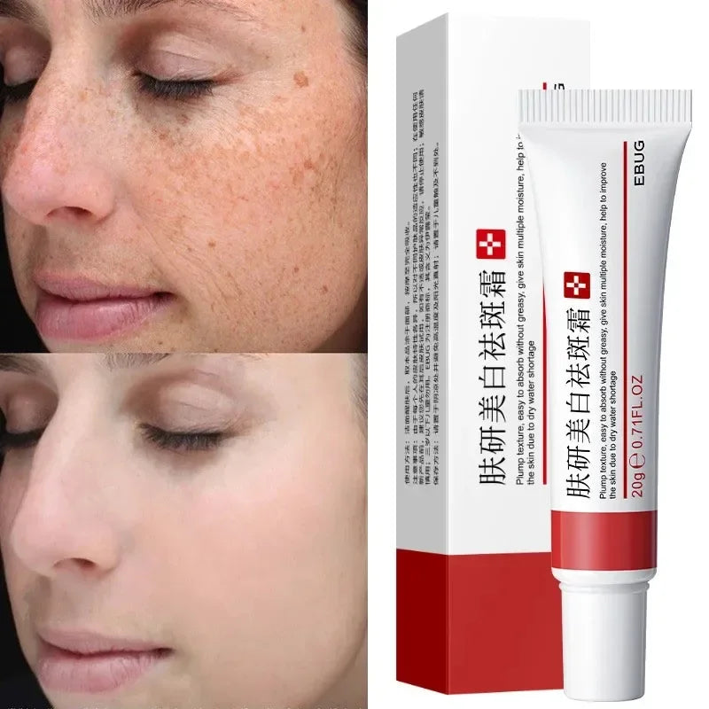 New Whiten Freckle Cream Effectively Removes Melasma Lightens Dark Spot Acne Marks Improve Dullness Fast Brighten Skin Care