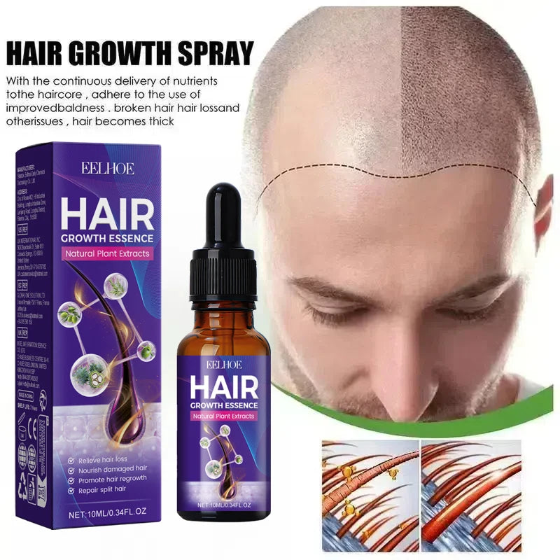 Hot selling product, 99% of buyers buy again, have more and more hair, say goodbye to baldness, thick hair