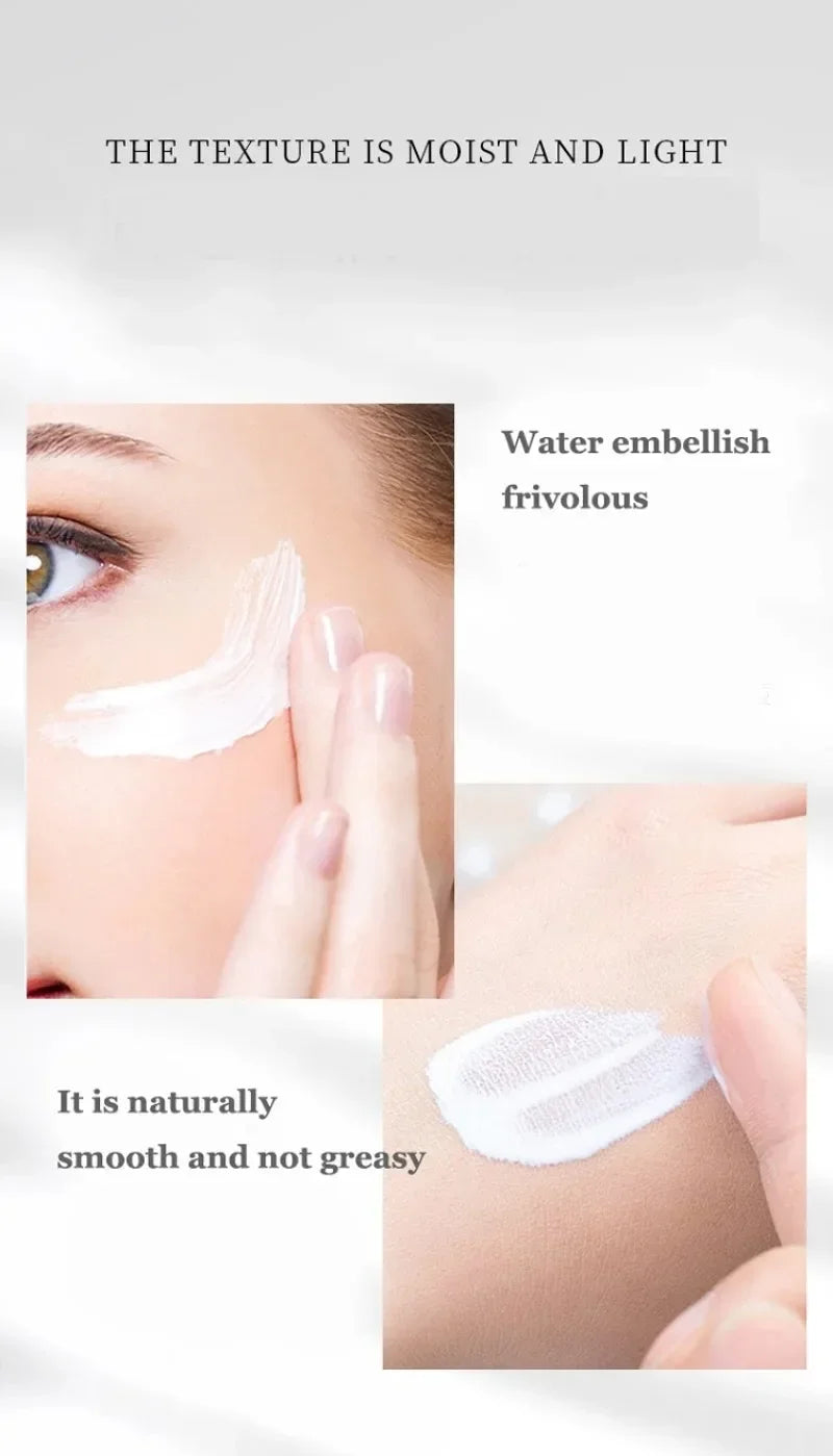 New Whiten Freckle Cream Effectively Removes Melasma Lightens Dark Spot Acne Marks Improve Dullness Fast Brighten Skin Care