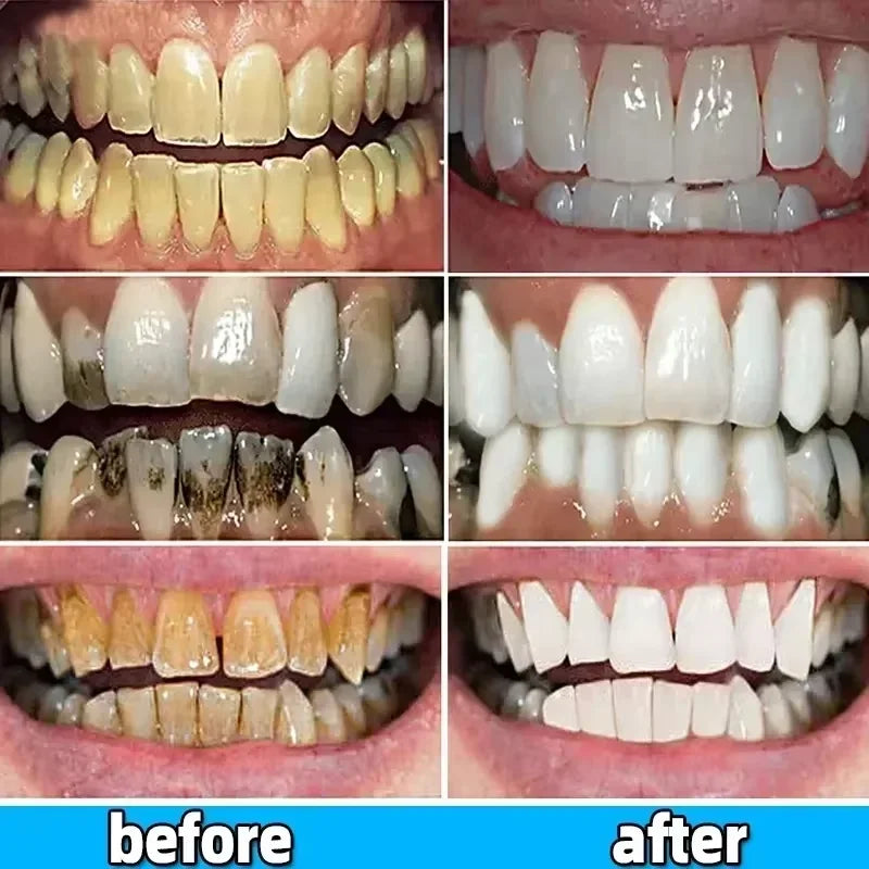 Teeth Whitening Toothpaste Dental Calculus Remover Remove Plaque Stains Prevent Periodontitis Cleaning Oral HygieneFresh Breath