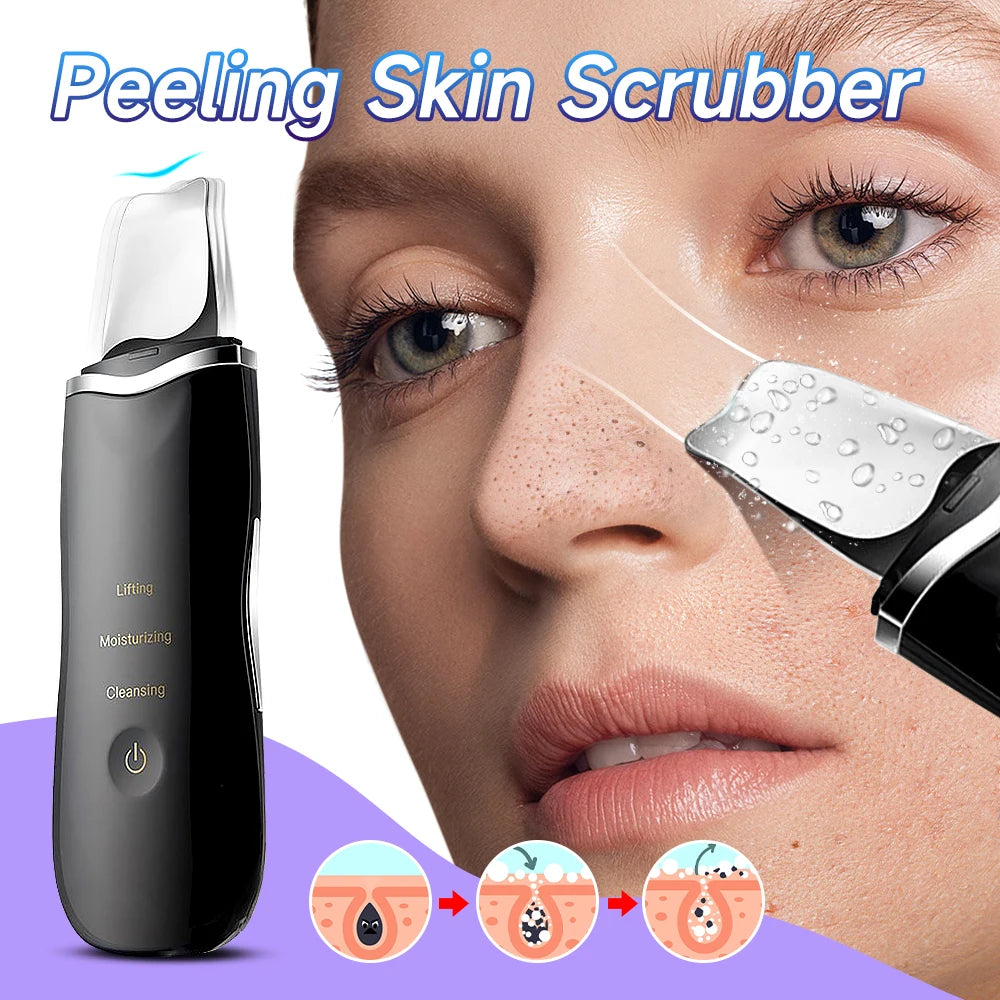 Ultrasonic Skin Scraper Peeling Blackhead Remover Deep Face Cleaning Lifting Acne Pore Cleaner Facial Spatula Shovel Cleanser