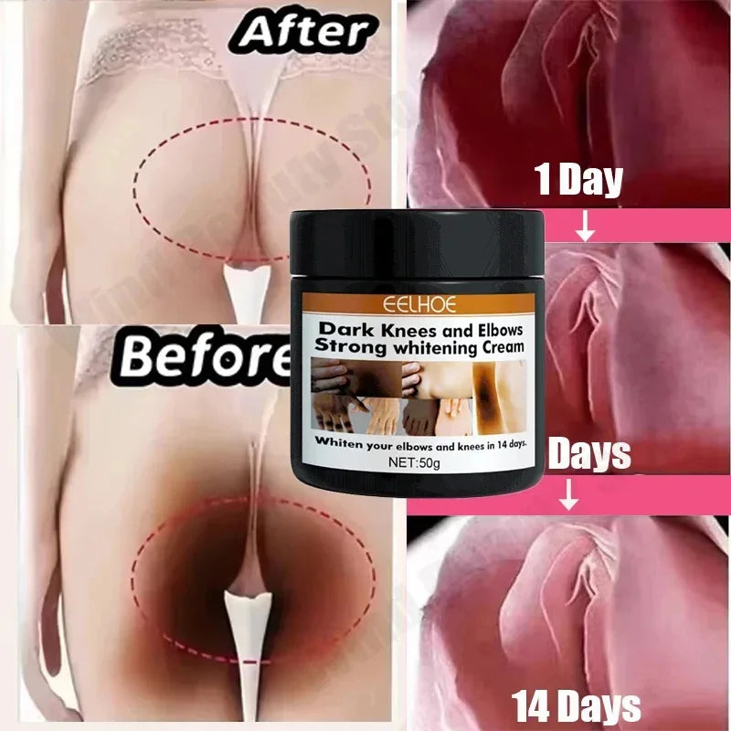 Body Whitening Cream Private Parts Underarm Bleaching Serum Whiten Butt Knee Brighten Inner Thigh Intimate Dark Remove Melanin