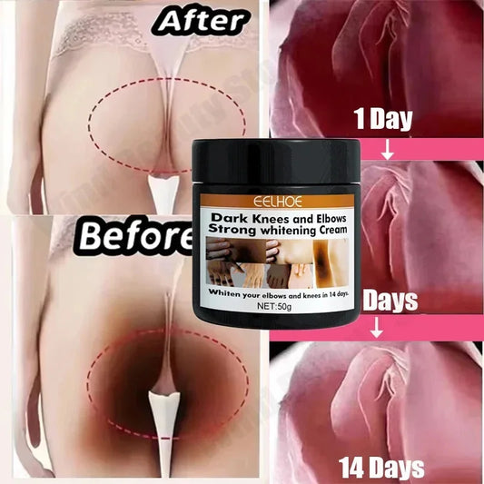 Body Whitening Cream Private Parts Underarm Bleaching Serum Whiten Butt Knee Brighten Inner Thigh Intimate Dark Remove Melanin